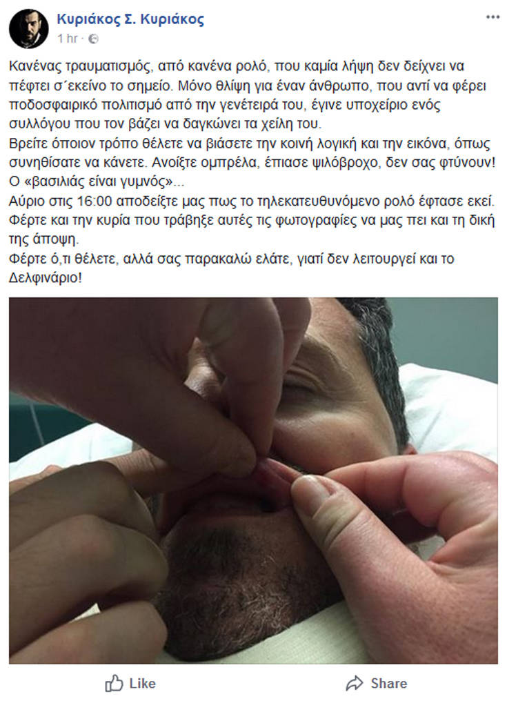 Κόντρα Ολυμπιακού-ΠΑΟΚ και μέσω φωτογραφιών για το εάν τραυματίστηκε ο Γκαρθία