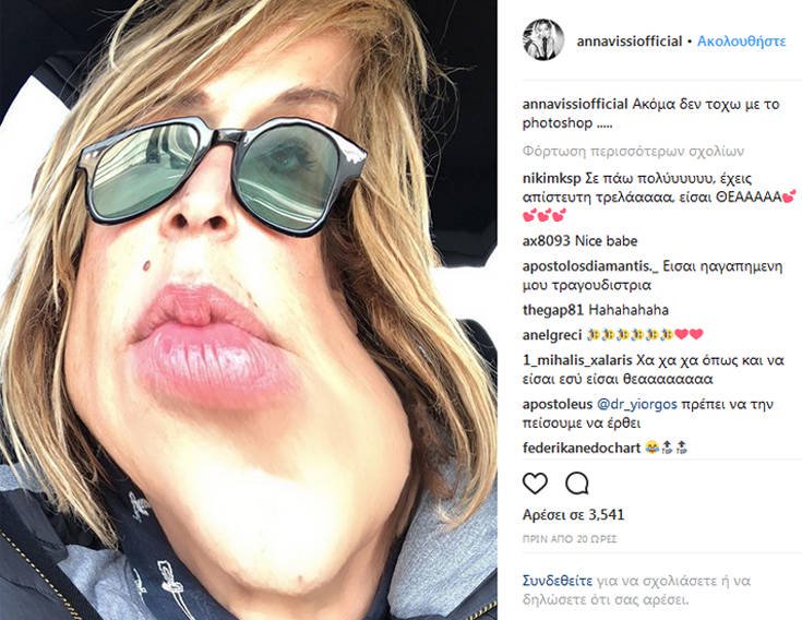 Η Άννα Βίσση το παράκανε με το Photoshop