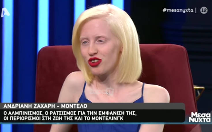 Μοντέλο με αλφισμό: Μητέρα είπε στο παιδί της να μην κάτσει δίπλα μου για να μην κολλήσει 4 tryryr