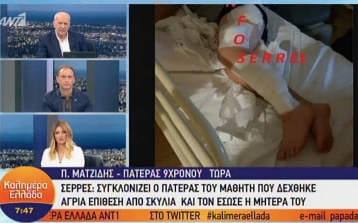 Πατέρας 9χρονου στις Σέρρες: Ένα χρόνο έκανα παράπονα που έβγαζε τα σκυλιά λυμένα 4 tyryruyt