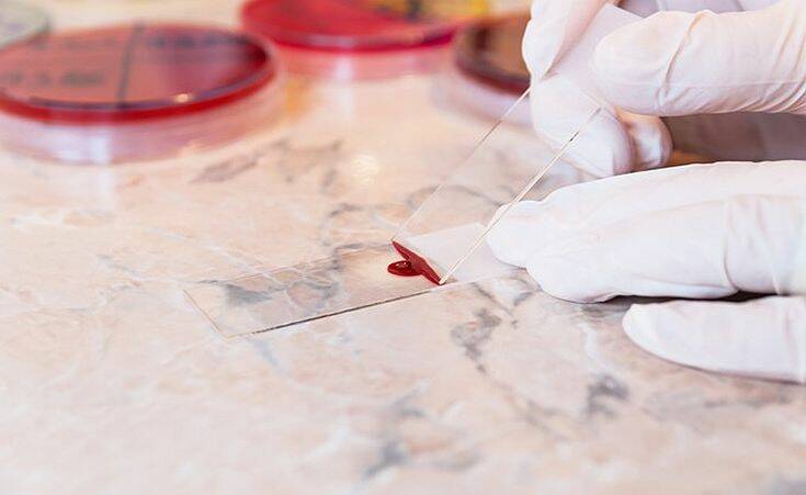 Ανοιχτό το ενδεχόμενο να παραχθεί στην Ελλάδα η «θεραπεία του Τραμπ» – Newsbeast