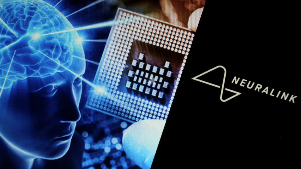 Î ÏÏÏÏÎ¿Ï Î¬Î½Î¸ÏÏÏÎ¿Ï Î¼Îµ ÏÏÎ¹Ï ÏÎ·Ï Neuralink Î¼ÏÏÏÎµÏÎµ Î½Î± ÎµÎ»Î­Î³Î¾ÎµÎ¹ ÏÎ¿ ÏÎ¿Î½ÏÎ¯ÎºÎ¹ ÏÎ¿Ï ÏÏÎ¿Î»Î¿Î³Î¹ÏÏÎ® Î¼Îµ ÏÎ· ÏÎºÎ­ÏÎ· ÏÎ¿Ï