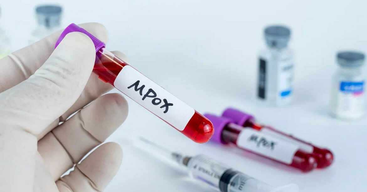 Ευλογιά των πιθήκων – Η mpox έφτασε ξανά στις Φιλιππίνες – Επιβεβαιώθηκε το πρώτο κρούσμα για το 2024