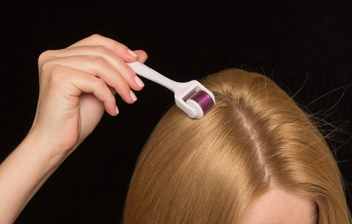 Μπορεί το dermaroller να καταπολεμήσει την τριχόπτωση;