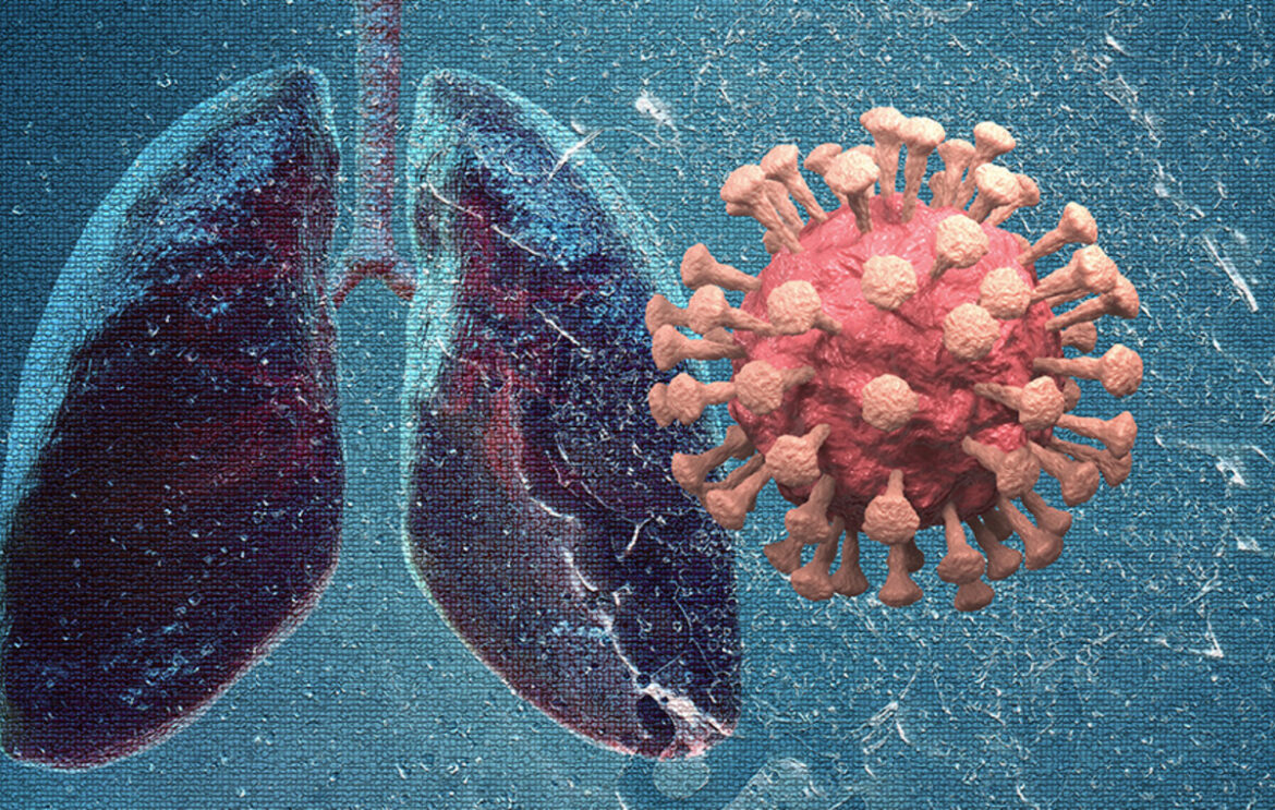 Ανωμαλίες στους πνεύμονες παρατηρήθηκαν σε παιδιά και έφηβους με long Covid